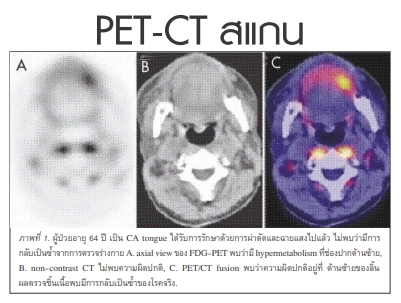 ความรู้เกี่ยวกับเครื่อง PET/CT    