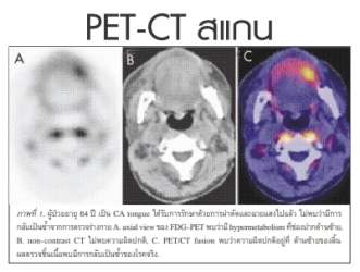 >ความรู้เกี่ยวกับเครื่อง PET/CT    