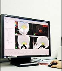 เครื่องวางแผนการรักษา (Treatment planning system)